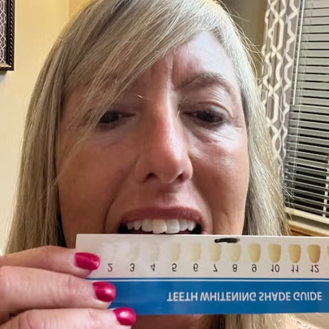 Review image